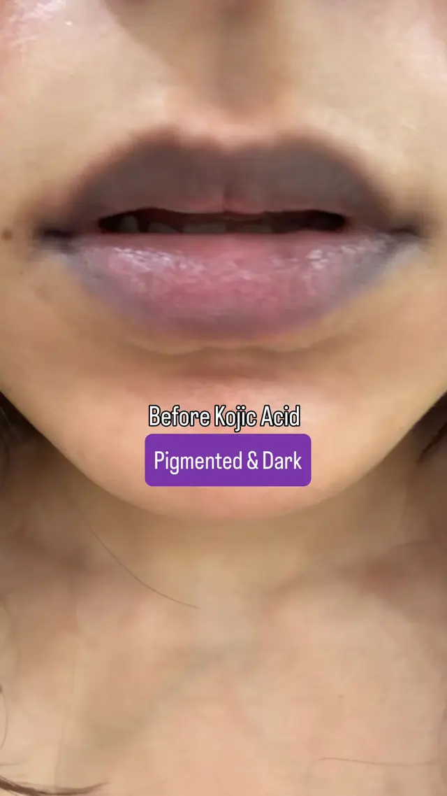 The Derma Co.
