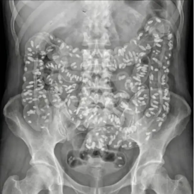 The Balanced Gut