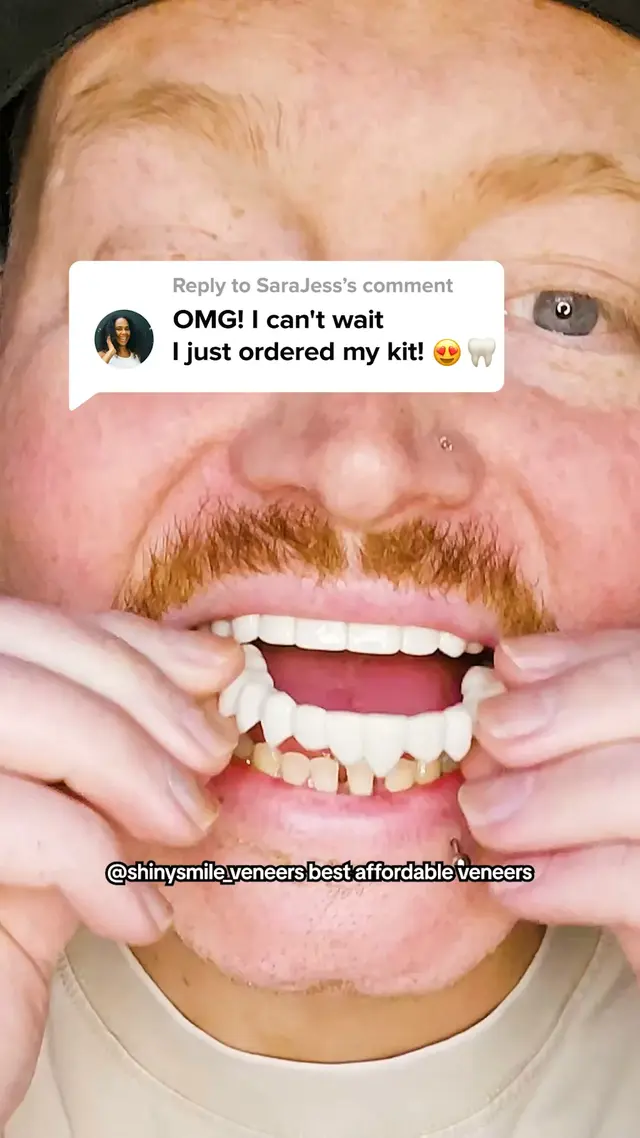 Shiny Smile Veneers