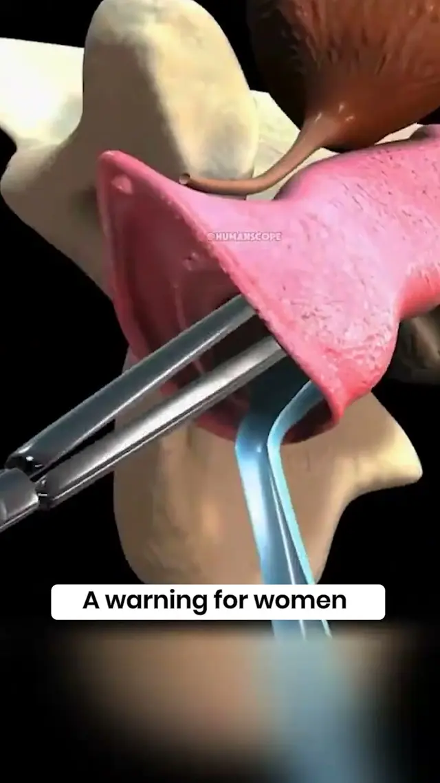 VCare