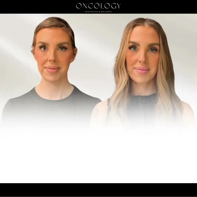 Oncology Aesthetics & Wellness