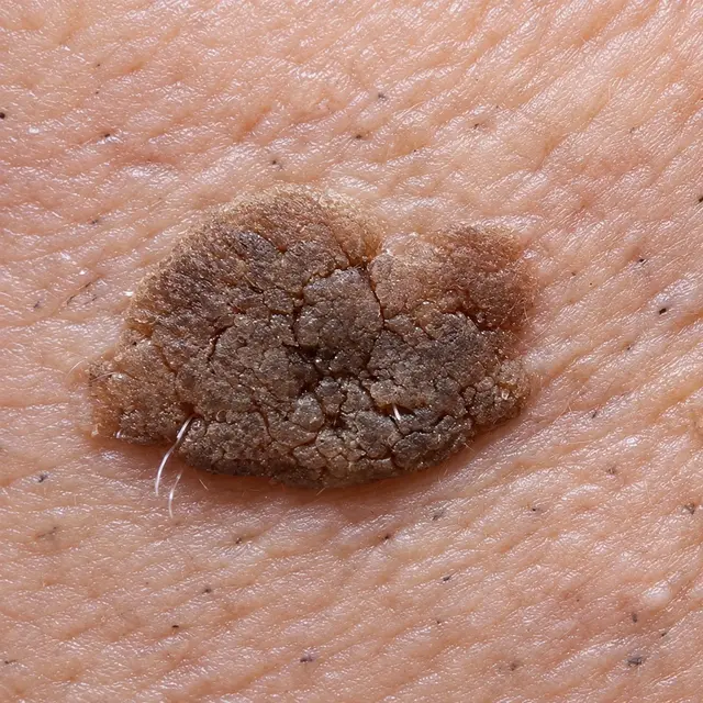 Naturalumi