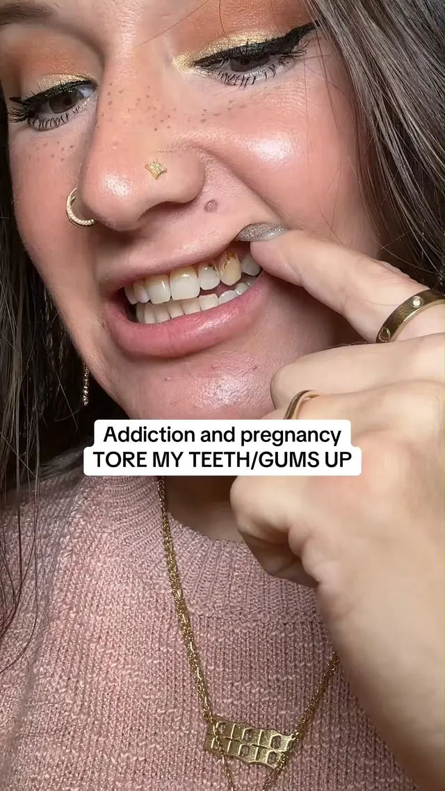 Ceelike Oral